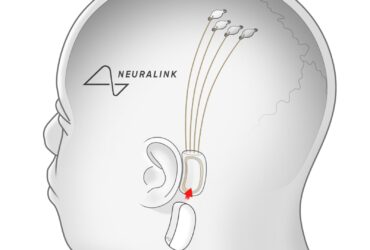 Elon Musk's Neuralink Secures 0M Investment Led by Founders Fund