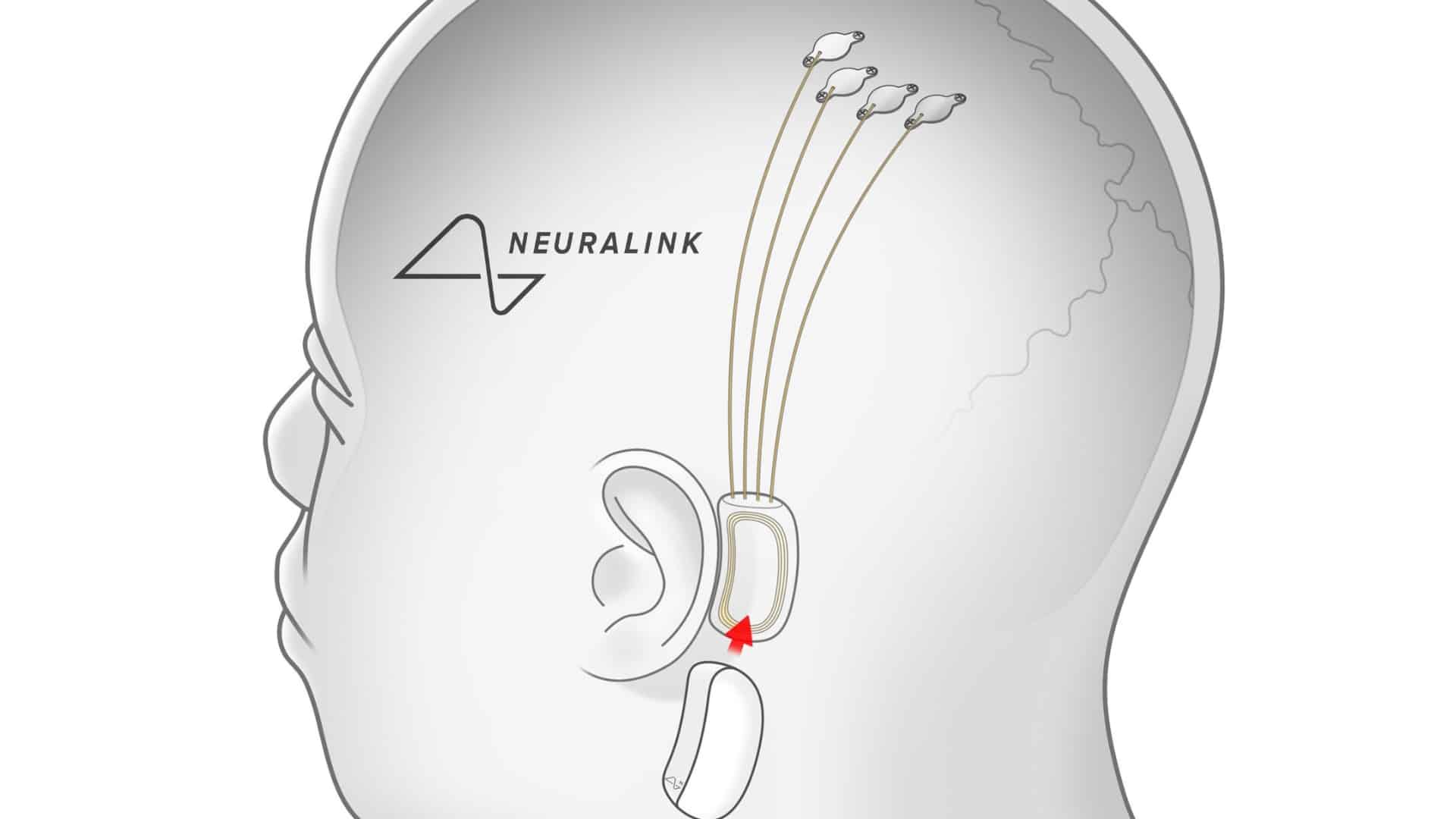 Elon Musk’s Neuralink Secures $280M Funding Led By Founders Fund – EGamers.io